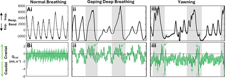 Image showing both abdominal expansion during breathing and cerebrospinal flow. This was measured during normal breathing, deep gaping breaths and yawns