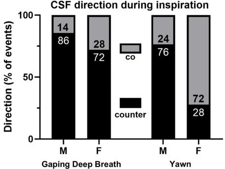 The MRI appears to affect male and female subjects differently.