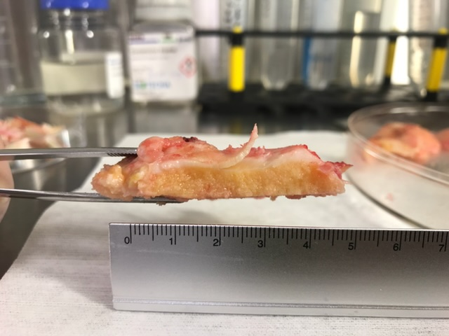 A sliver of human articular cartilage held in forceps above a ruler, its pale glassy layer sitting on pink bone