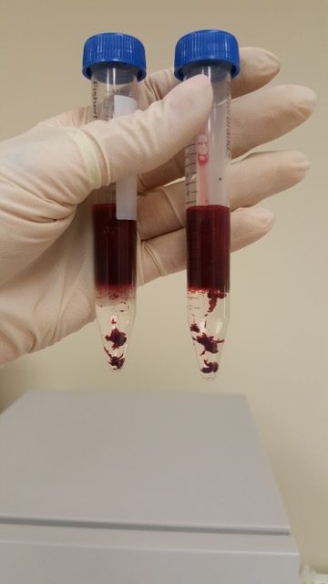 A gloved hand holding two capped centrifuge tubes containing dark red menstrual blood layered over a Ficoll gradient