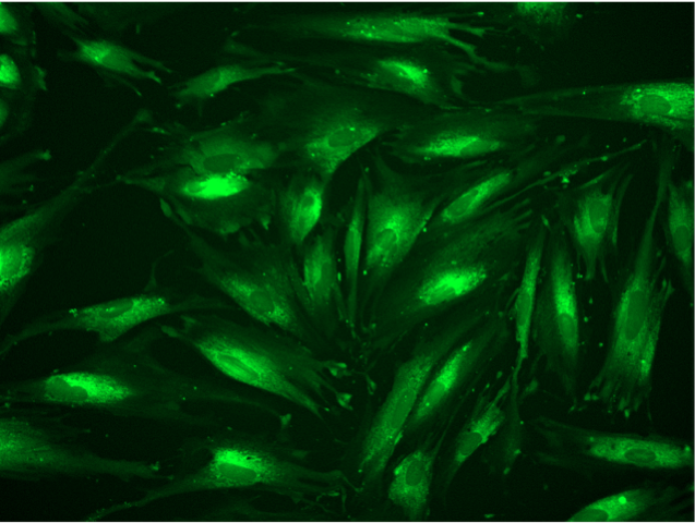 Fluorescence micrograph showing elongated menstrual blood mesenchymal stromal cells glowing green against a black background