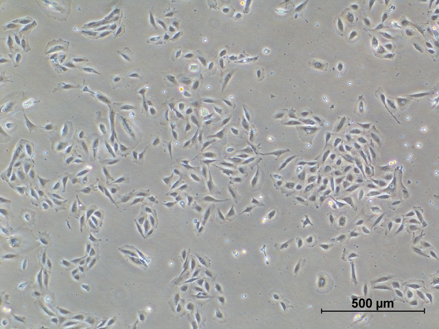 Phase-contrast micrograph of spindle-shaped menstrual blood stromal cells spread across a culture surface, with a 500 micrometre scale bar