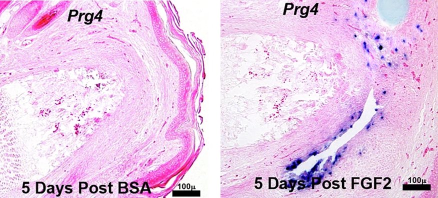 Two stained tissue sections side by side. The left is evenly pink; the right has dark purple spots clustered along a narrow cleft.